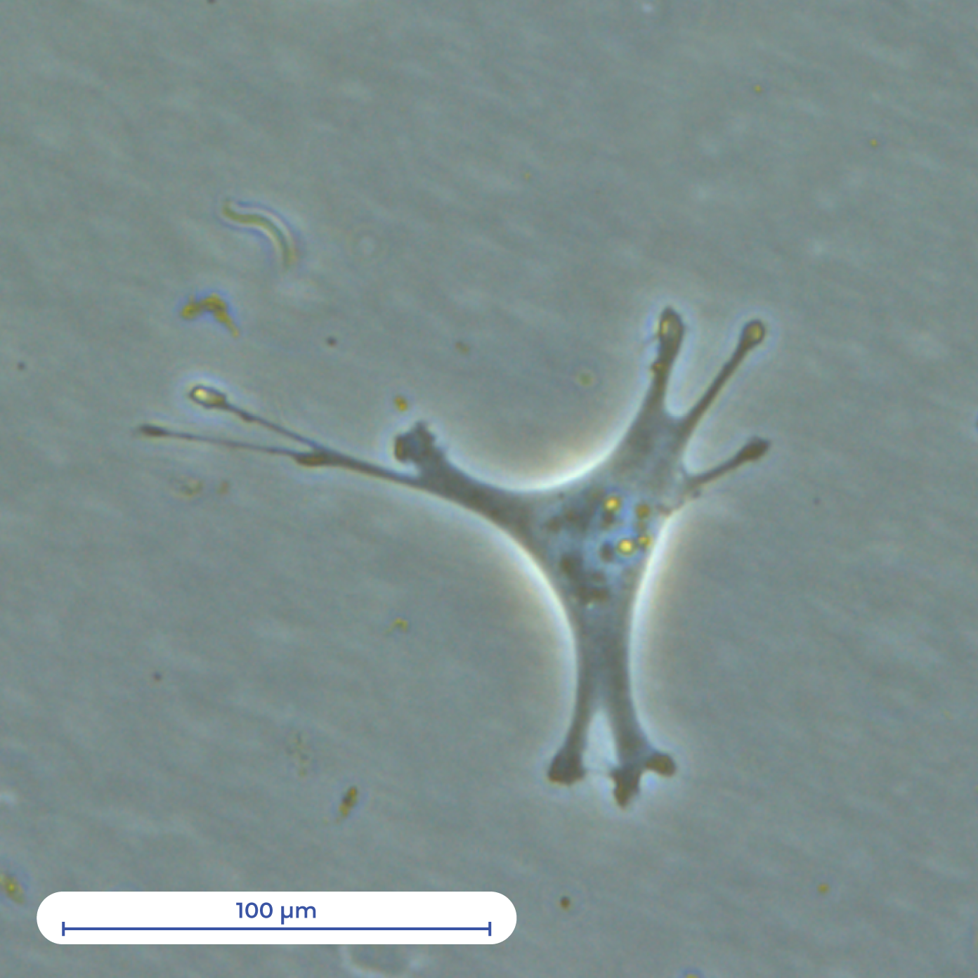 IST_ourlabs-Astrocyte-2