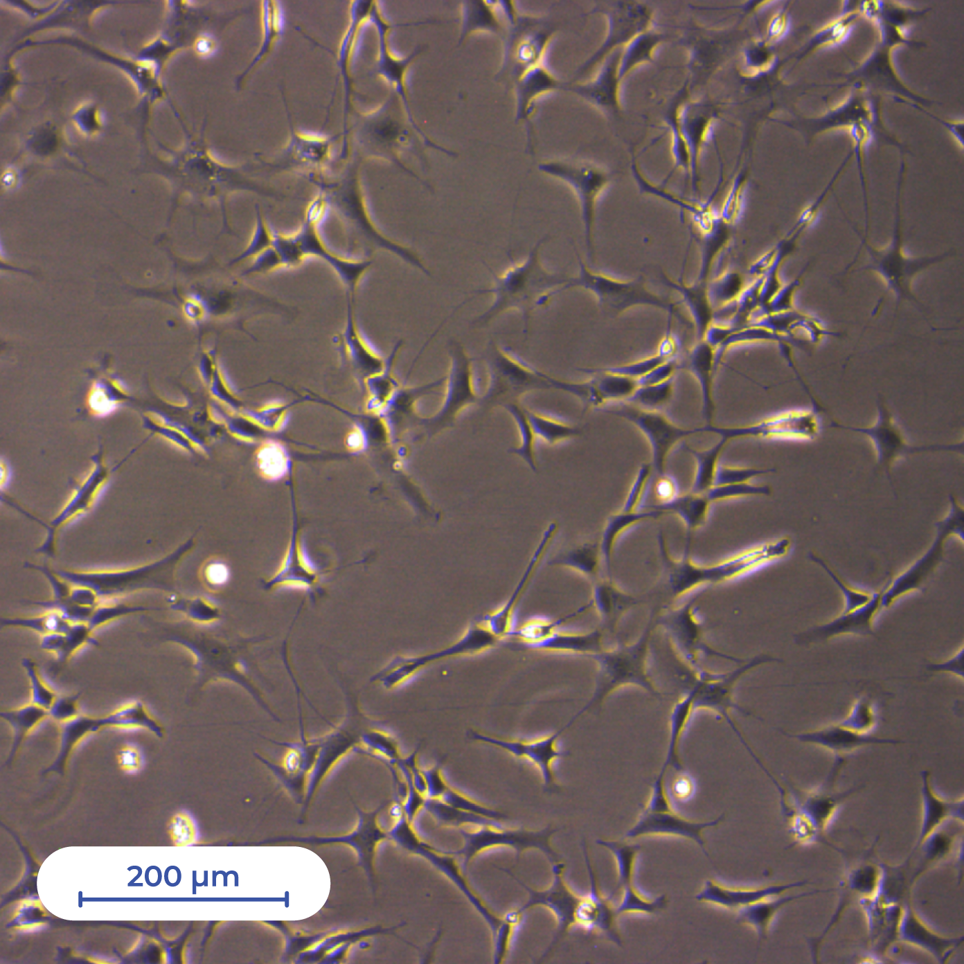 IST_ourlabs-hiPSC