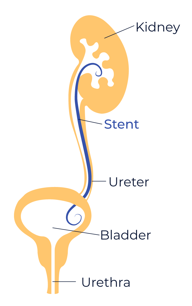 Kidney-diagram-b